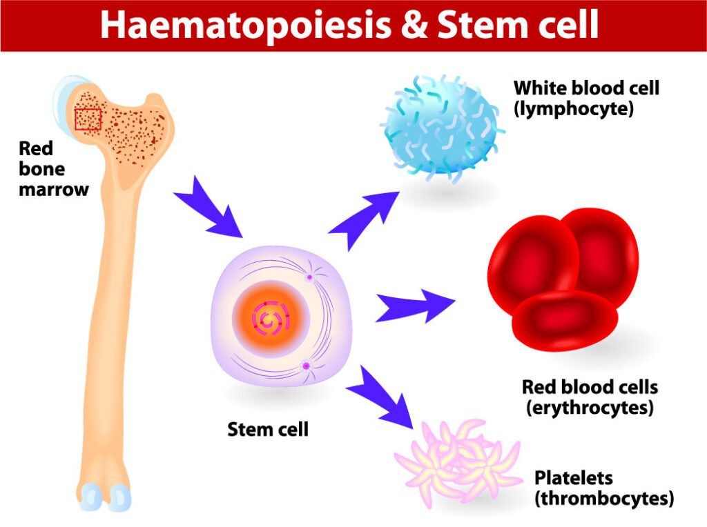 define autologous stem cell transplant